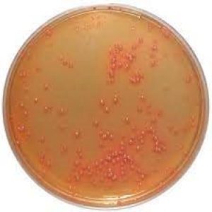 Hektoen Enteric Agar